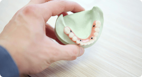 Dental Crown