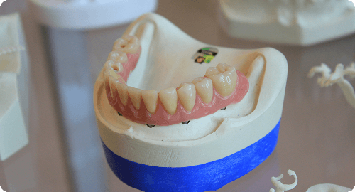 Dental Bridge