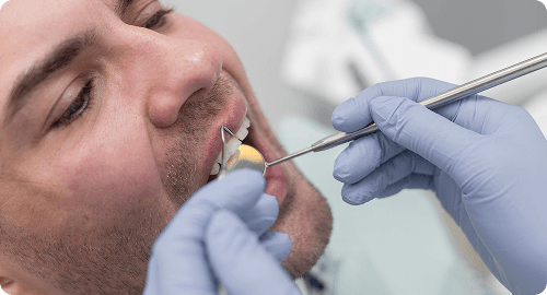 Gum Disease Treatment